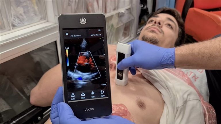 MDA brings ultrasound to ambulances and helicopters.